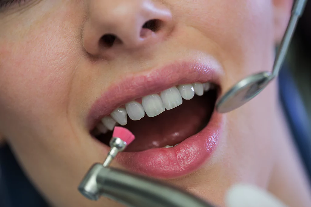 Safety and Protection for Your Teeth